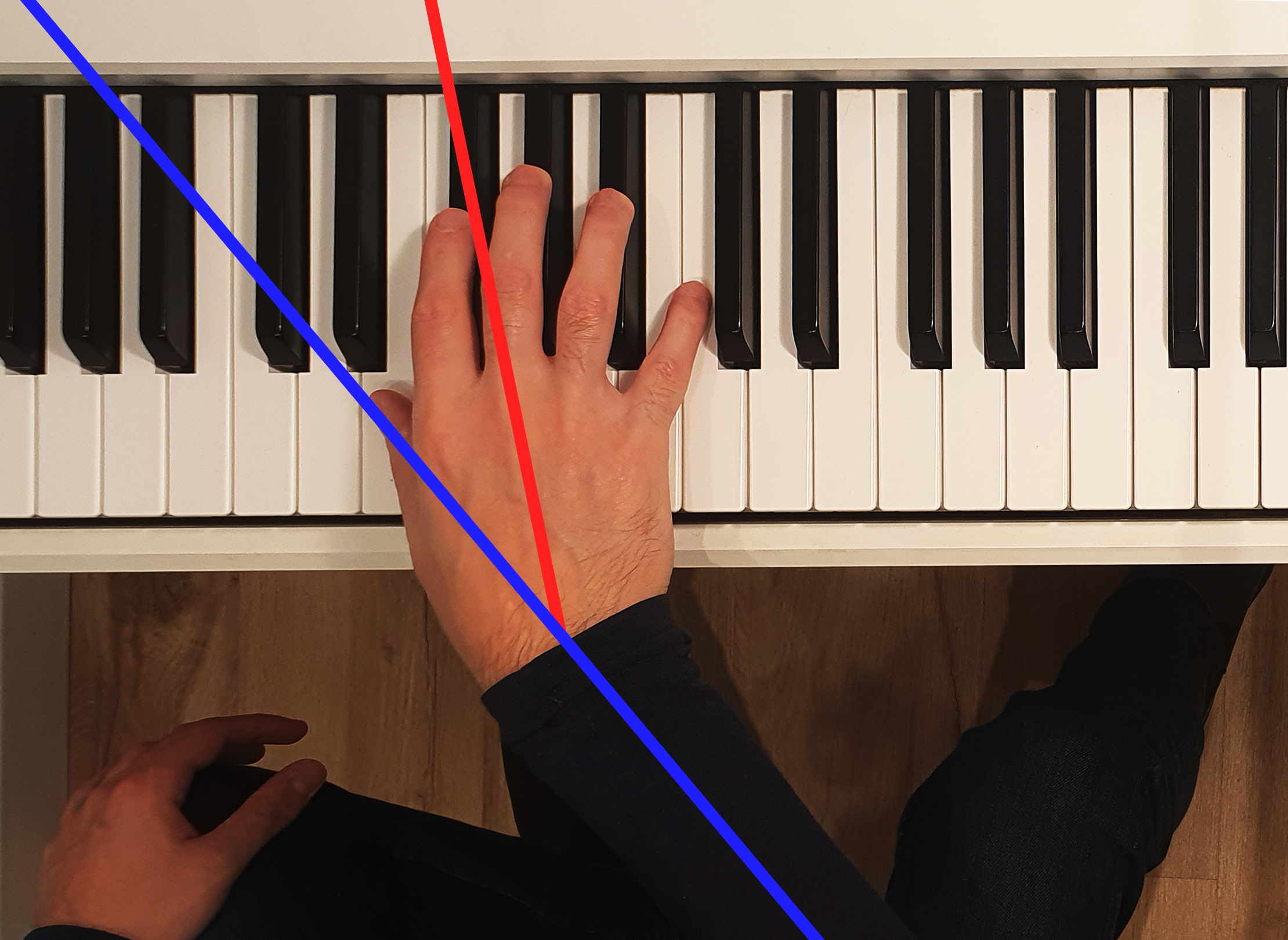 Hand Deviation Movements of the wrist